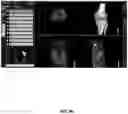 Fig. 91 - System and method for providing surgical planning and guidance with three-dimensional visualization