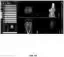 Fig. 94 - System and method for providing surgical planning and guidance with three-dimensional visualization