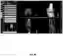 Fig. 95 - System and method for providing surgical planning and guidance with three-dimensional visualization