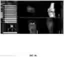 Fig. 96 - System and method for providing surgical planning and guidance with three-dimensional visualization