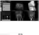 Fig. 99 - System and method for providing surgical planning and guidance with three-dimensional visualization