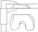 Fig. 01 - SYSTEM AND METHOD FOR ASSISTING ORTHOPEADICS SURGERIES