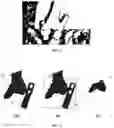 Fig. 03 - SYSTEM AND METHOD FOR ASSISTING ORTHOPEADICS SURGERIES
