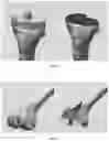 Fig. 05 - SYSTEM AND METHOD FOR ASSISTING ORTHOPEADICS SURGERIES
