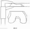 Fig. 06 - SYSTEM AND METHOD FOR ASSISTING ORTHOPEADICS SURGERIES