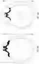 Fig. 07 - Systems and methods for electrode orientation determination in deep brain stimulation (DBS)