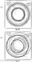 Fig. 11 - SYSTEMS AND METHODS FOR AIMING AND ALIGNING OF A TREATMENT TOOL WITHIN AN X-RAY DEVICE OR AN ULTRASOUND DEVICE ENVIRONMENT