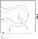 Fig. 04 - Surgical tool calibration