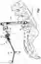 Fig. 02 - Assembly for coupling a patient reference array to a medical implant such as a pedicle screw