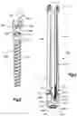 Fig. 04 - Assembly for coupling a patient reference array to a medical implant such as a pedicle screw