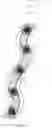 Fig. 05 - Magnetic flexible catheter tracking system and method using digital magnetometers