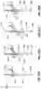 Fig. 32 - SURGICAL ROBOTIC AUTOMATION WITH TRACKING MARKERS AND CONTROLLED TOOL ADVANCEMENT