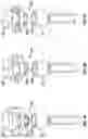 Fig. 07 - OPHTHALMIC SURGICAL SYSTEMS, METHODS, AND DEVICES