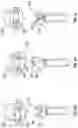 Fig. 09 - OPHTHALMIC SURGICAL SYSTEMS, METHODS, AND DEVICES