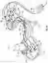 Fig. 12 - OPHTHALMIC SURGICAL SYSTEMS, METHODS, AND DEVICES