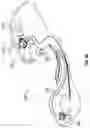 Fig. 16 - OPHTHALMIC SURGICAL SYSTEMS, METHODS, AND DEVICES