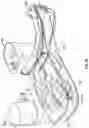 Fig. 22 - OPHTHALMIC SURGICAL SYSTEMS, METHODS, AND DEVICES