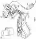 Fig. 24 - OPHTHALMIC SURGICAL SYSTEMS, METHODS, AND DEVICES