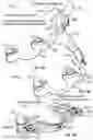 Fig. 34 - OPHTHALMIC SURGICAL SYSTEMS, METHODS, AND DEVICES