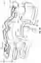 Fig. 36 - OPHTHALMIC SURGICAL SYSTEMS, METHODS, AND DEVICES
