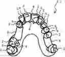 Fig. 01 - Method for producing an aligner