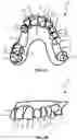 Fig. 03 - Method for producing an aligner