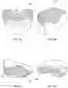 Fig. 02 - Palatal expanders and methods of forming the same