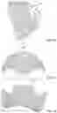 Fig. 03 - Palatal expanders and methods of forming the same
