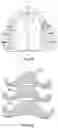 Fig. 06 - Palatal expanders and methods of forming the same