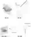 Fig. 12 - Palatal expanders and methods of forming the same