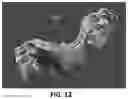 Fig. 14 - Palatal expanders and methods of forming the same