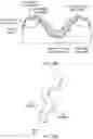 Fig. 15 - Palatal expanders and methods of forming the same