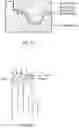 Fig. 35 - Palatal expanders and methods of forming the same