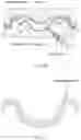 Fig. 38 - Palatal expanders and methods of forming the same
