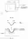 Fig. 42 - Palatal expanders and methods of forming the same