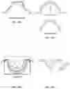 Fig. 43 - Palatal expanders and methods of forming the same