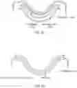 Fig. 45 - Palatal expanders and methods of forming the same
