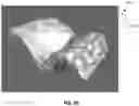 Fig. 49 - Palatal expanders and methods of forming the same