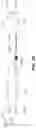 Fig. 06 - Force applying device for orthodontic treatment