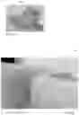 Fig. 09 - Device for dental hygiene