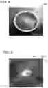 Fig. 04 - BIOMEDICAL PATCHES WITH ALIGNED FIBERS