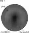 Fig. 09 - BIOMEDICAL PATCHES WITH ALIGNED FIBERS