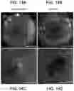 Fig. 10 - BIOMEDICAL PATCHES WITH ALIGNED FIBERS