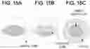 Fig. 11 - BIOMEDICAL PATCHES WITH ALIGNED FIBERS