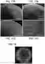 Fig. 13 - BIOMEDICAL PATCHES WITH ALIGNED FIBERS
