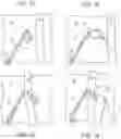 Fig. 05 - TENSIONABLE KNOTLESS ANCHORS AND METHODS OF TISSUE REPAIR
