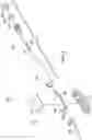 Fig. 04 - HAPTIC MANAGEMENT FOR DELIVERY OF INTRAOCULAR IMPLANTS