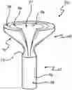 Fig. 01 - Sinus Stent And Systems And Methods Of Deploying A Stent Within The Sinus Of A Patient