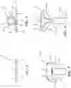 Fig. 06 - Sinus Stent And Systems And Methods Of Deploying A Stent Within The Sinus Of A Patient