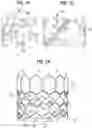 Fig. 06 - PROSTHETIC HEART VALVE